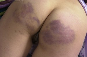 Spanking Teen Brandi - Spanked On My Bruised Bottom - image 11